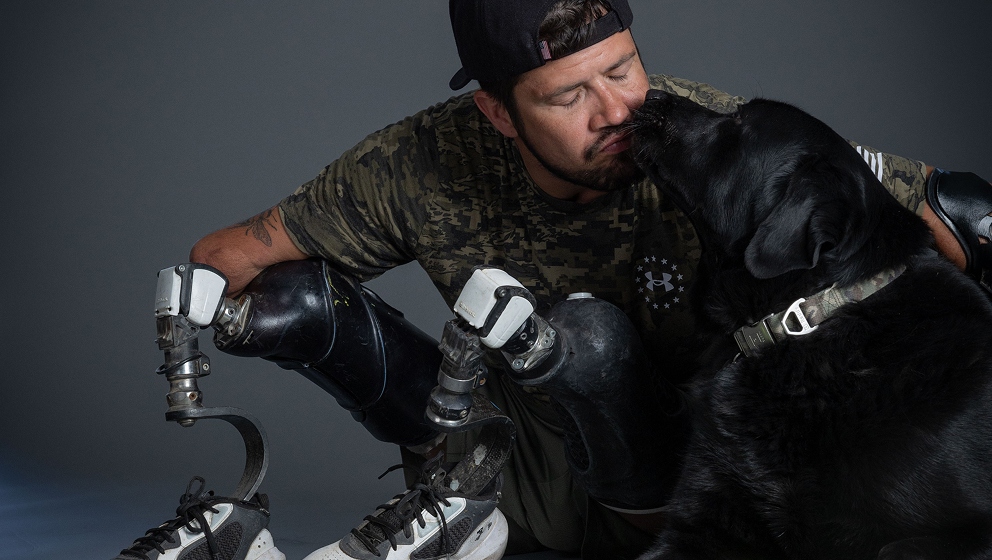 CHAMP Assistance Dogs client, a veteran with prosthetic arms and legs, bonding with his black Labrador service dog.